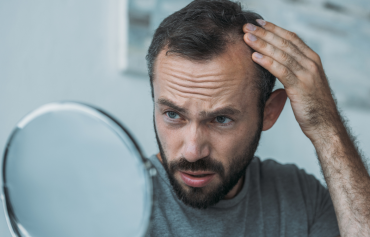 Hair Loss Treatments