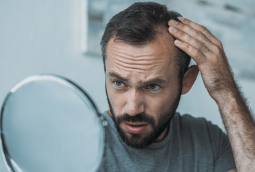 Hair Loss Treatments